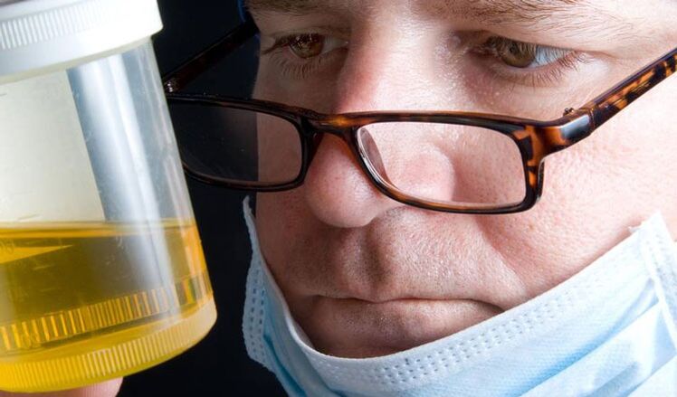 urineanalyse voor chronische prostatitis